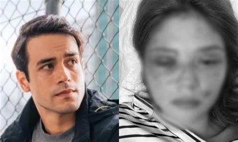 kit thompson scandal|Charges filed vs actor Kit Thompson for allegedly beating  .